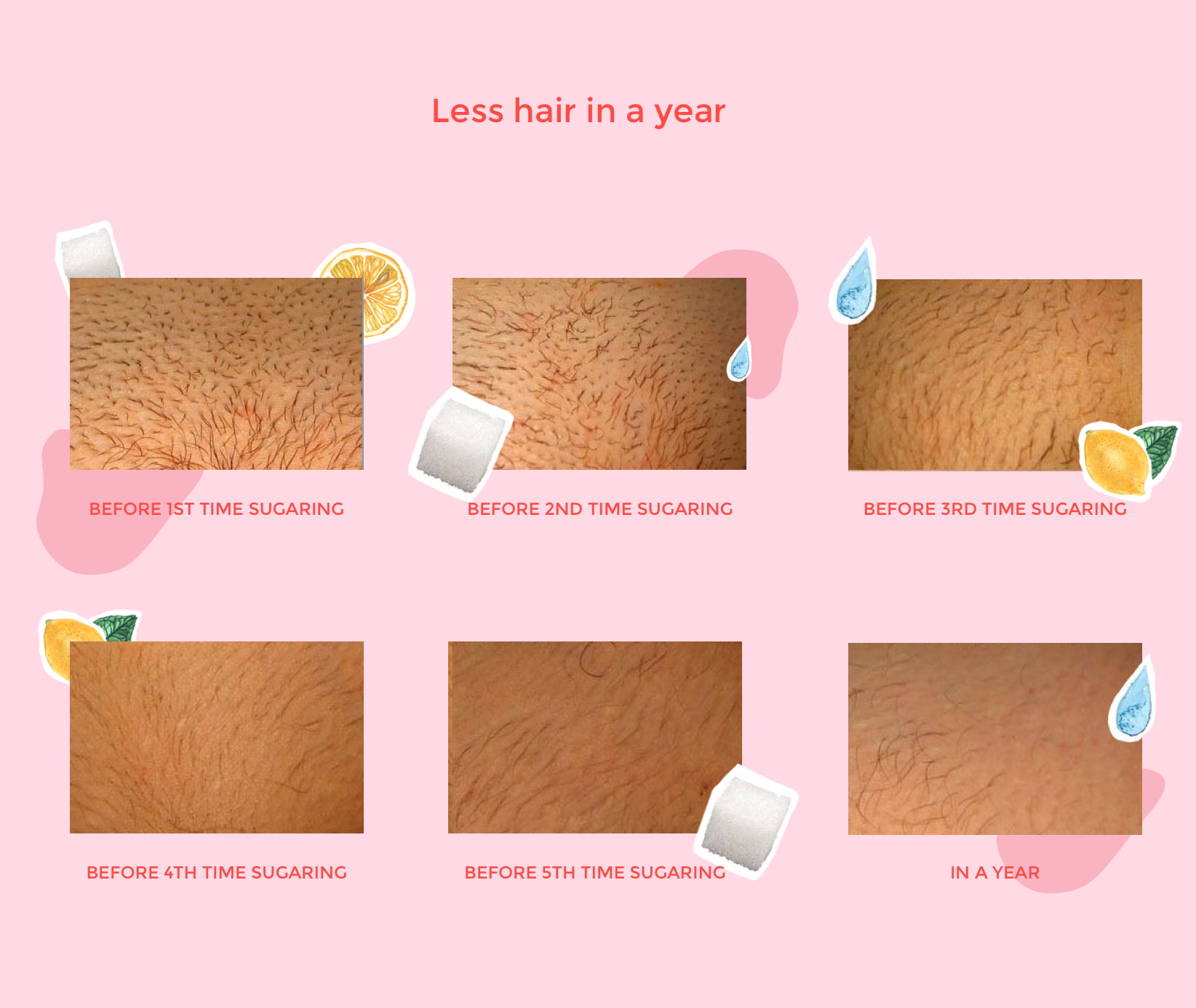 Arm Hands Sugaring hair removal by Sugaring NYC Franchise