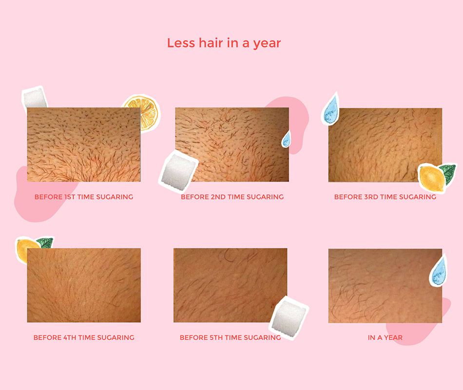 https://dev.sugaringnyc.com/wp-content/uploads/2023/03/brazilian-Sugaring-hair-Removal-Near-Me.jpeg